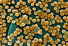 Ingekleurde foto van een bacterie in een elektronenmicroscoop