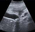 Medical Ultrasound