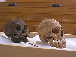 Comparação entre o crânio LB1 (à esquerda) e crânio de humano moderno com microcefalia.