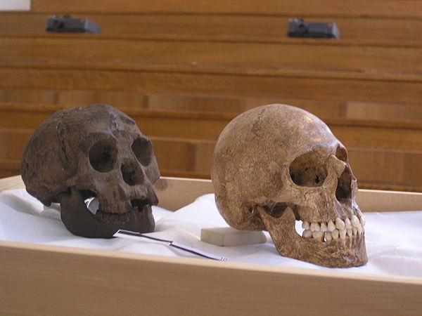 LB1 (left) vs. microcephalic human (right)