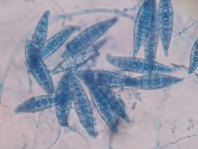 Description de l'image Macroconidia Microsporum canis.JPG.