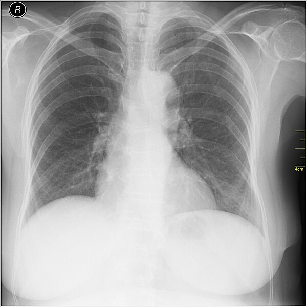 File:Medical X-Ray imaging QSR06 nevit.jpg