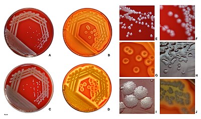 Pseudomonas aeruginosa