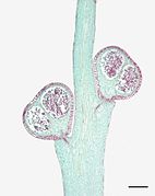 Photomicrographie d'une coupe longitudinale de tige et sporanges de Psiltum nudum (échelle : 1,0 mm)