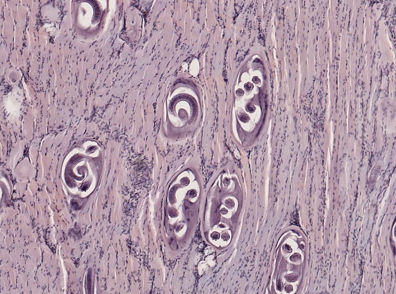 File:Trichinella spiralis (YPM IZ 093396).jpeg