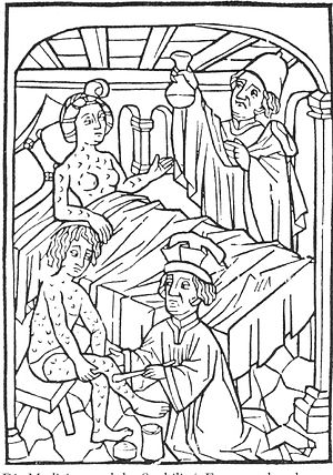 Середньовічна лікарня для хворих на сифіліс, дереворит 1496 року