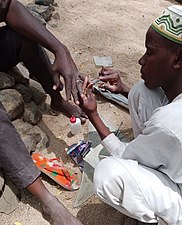 Autre vue de la santé des ongles à Maroua. Photographer : User:Bisna constant