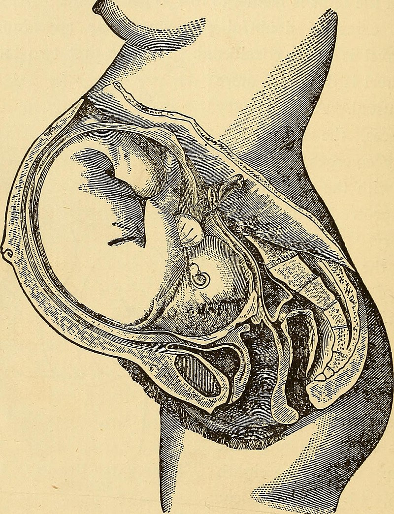 Drawing of a sagittal cross-section of a fetus in the pregnant parent's amniotic cavity.
