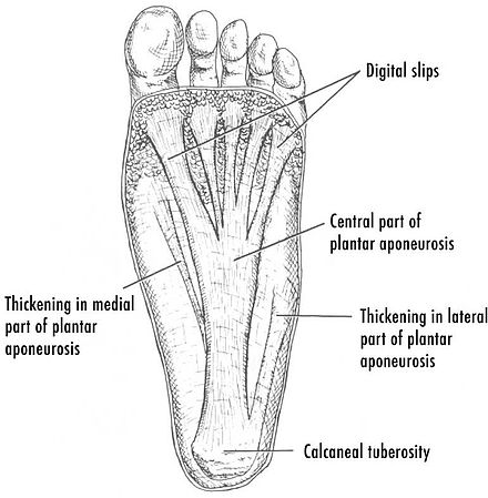 Drawing of the plantar fascia