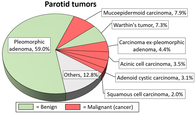 File:Relative incidence of parotid tumors.png