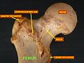 Superior epiphysis - anterior view