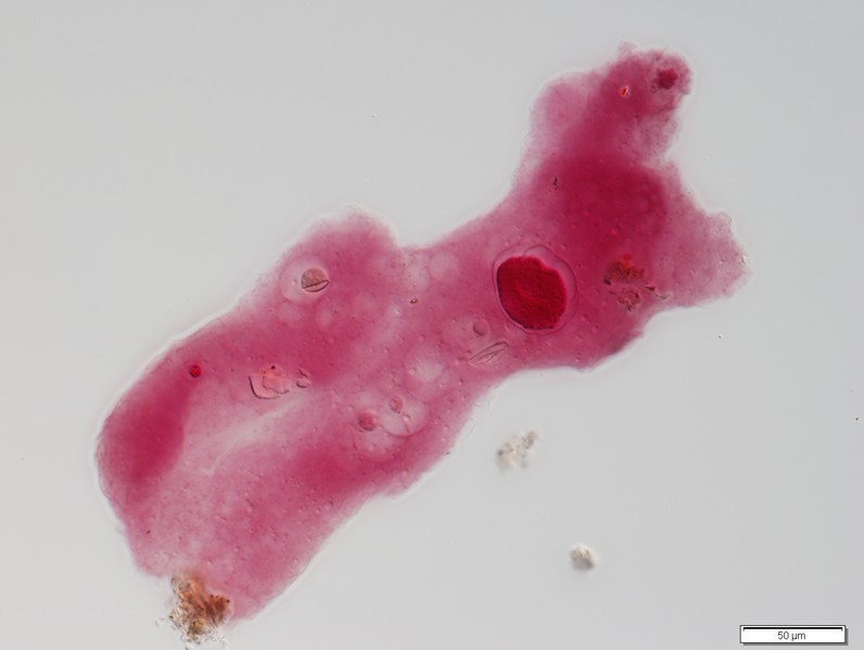 File:Collection Penard MHNG Specimen 27-1-2 Amoeba proteus.tif