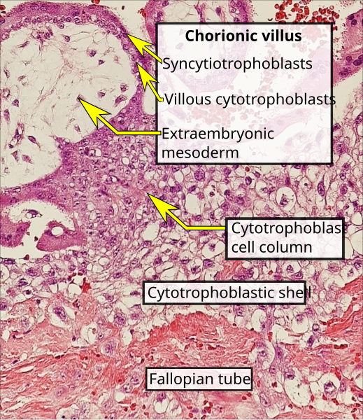 File:Histopathology of tubal pregnancy.svg