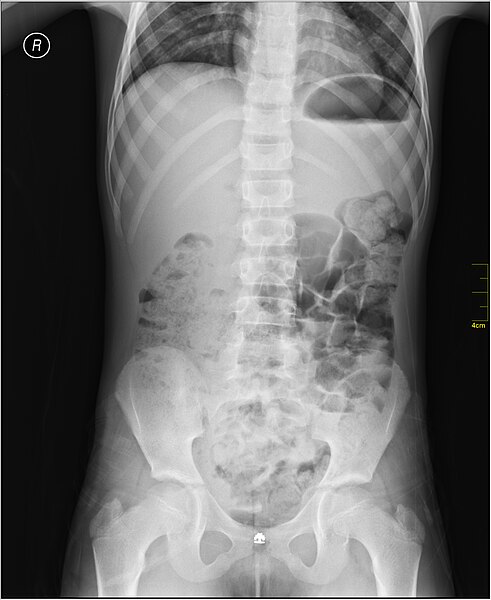 File:Medical X-Ray imaging SMX07 nevit.jpg