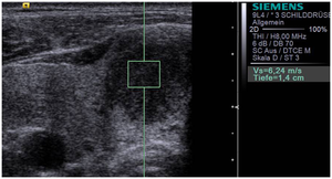 Elastography