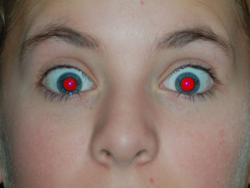 red bloodshot eyes