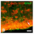 January 9: Glial distribution of Cu/Zn SOD immunoreactivity in intact immature brain