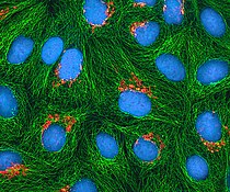 海拉細胞的高爾基體（橙色），微管（綠色）和染色体（青色）的多光子螢光圖像。