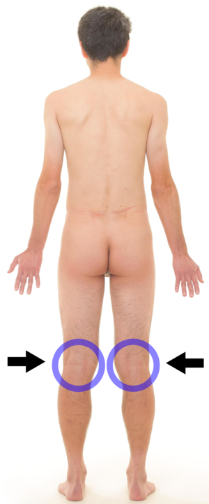 Posterior view of human male - popliteal fossa.png