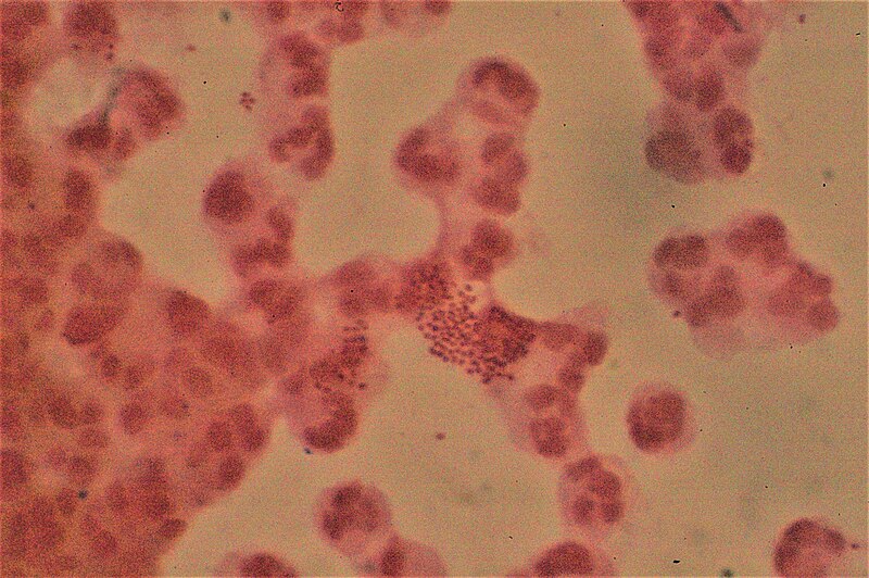 File:Pus cells with Neisseria gonorrhoeae.jpg