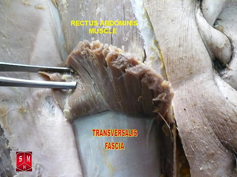 File:Rectus abdominis muscle 2.jpg