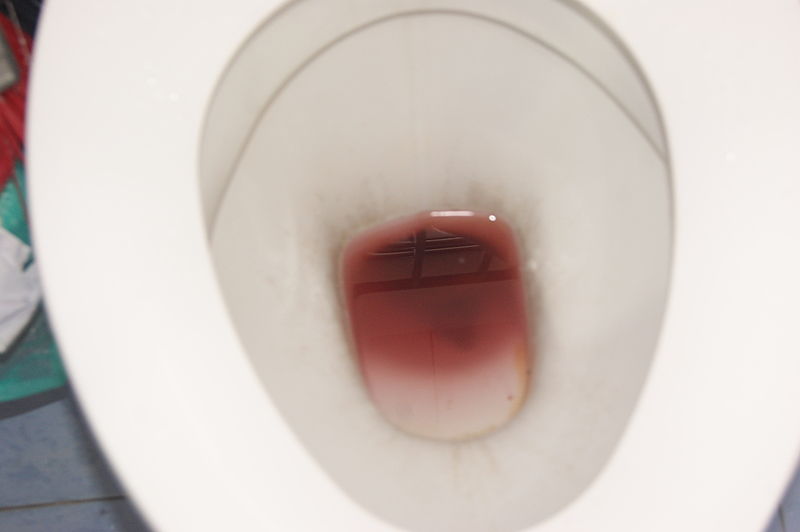 File:Reddish stool in toilet bowl water due to dragon fruit consumption.jpg