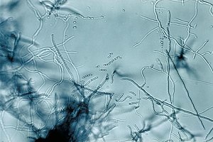 Streptomyces, под световым микроскопом