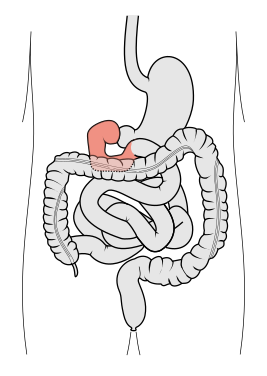 267px Tractus intestinalis duodenum.svg