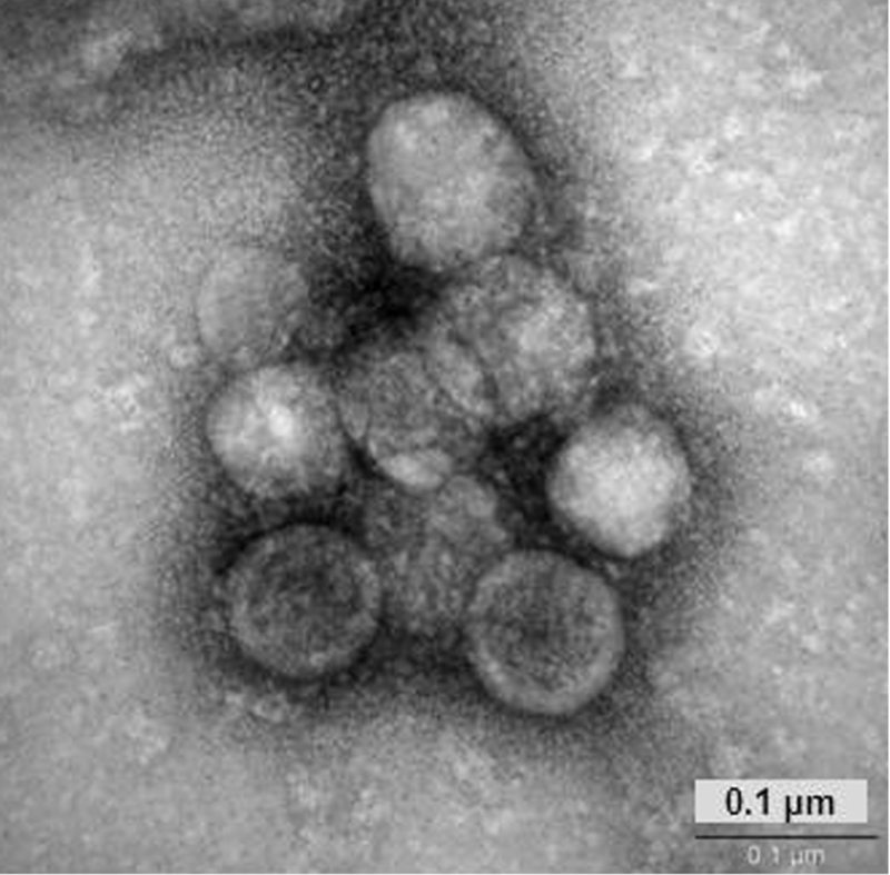Transmissionselektronenmikroskopische Aufnahme des HCoV-NL63-Virus.