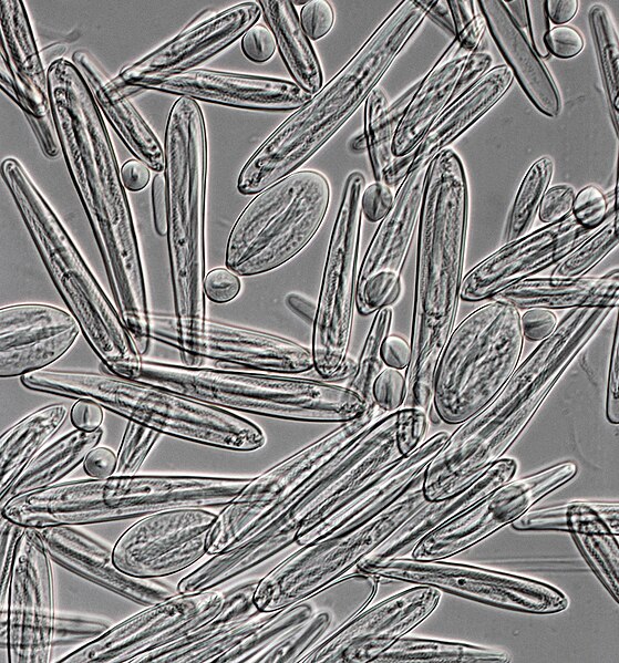 Nematocysts from Chironex fleckeri (400x magnification)