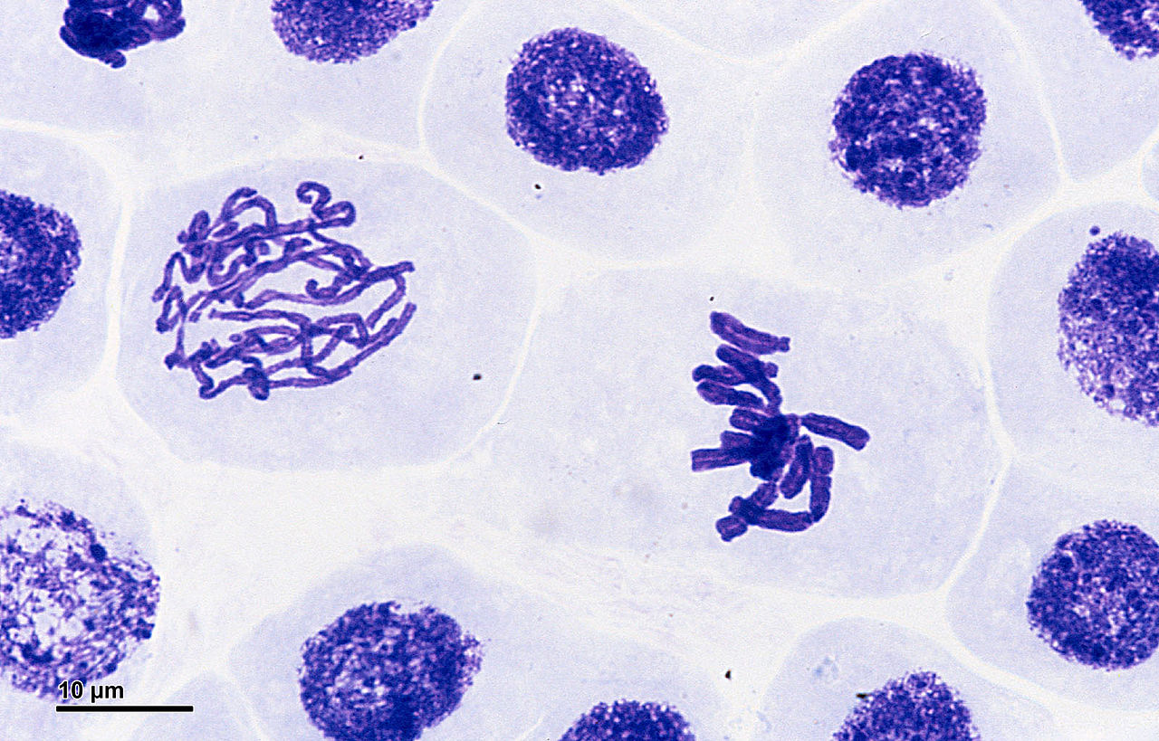 1280px Mitosis_%28261_03%29_Pressed%3B_root_meristem_of_Vicia_faba_%28cells_in_prophase%2C_metaphase%29