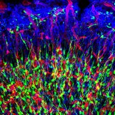 Immunofluorescence staining of neural progenitor cells (green), vasculature (red), and astrocytes (blue). Neural progenitors in olfactory bulb.tif