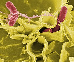 صورة مجهرية إلكترونية تظهر مهاجمة Salmonella typhimurium (بلون أحمر) لخلايا بشرية مزروعة
