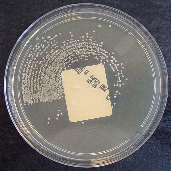 File:Staphylococcus aureus on ChromID CPS chromogenic agar.jpg