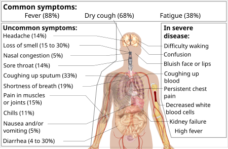 ไฟล์:Symptoms of coronavirus disease 2019 3.0.svg