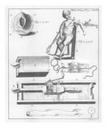 Миниатюра для Файл:The Description of an Instrument for Reducing a Dislocated Shoulder; Invented by Mr. John Freke, Surgeon of St. Bartholomew's Hospital, and F. R. S. (IA jstor-104210).pdf