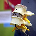 Vertebre-IMG 0032.jpg