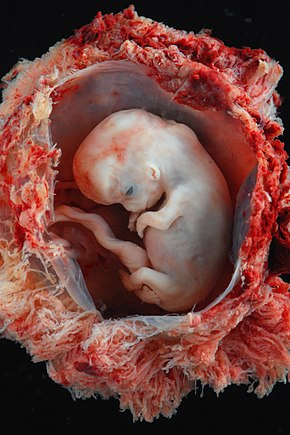Embryo - approximately 8 weeks from conception, 10 weeks estimated gestational age from LMP.jpg