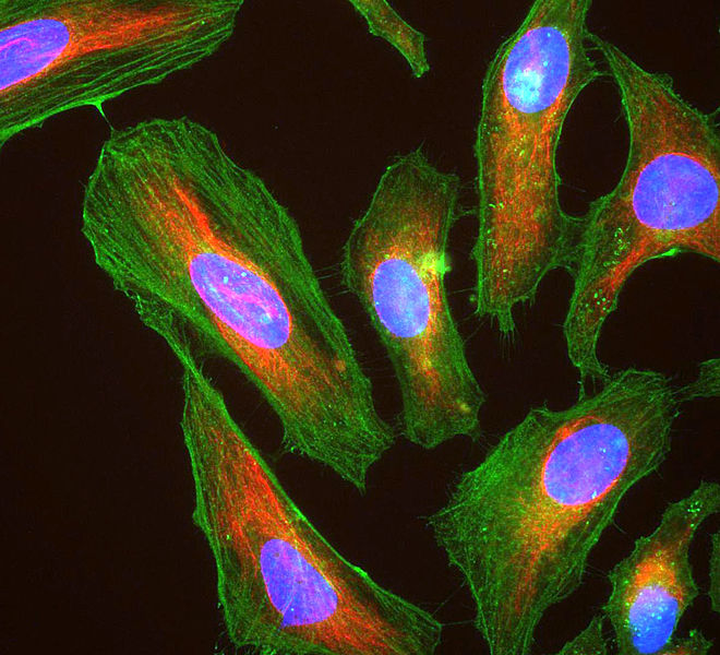 File:HeLa cells stained with antibody to actin (green) , vimentin (red) and DNA (blue).jpg