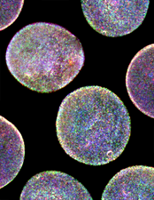 Immunostaining of capsule-bound cells (CBCs).png