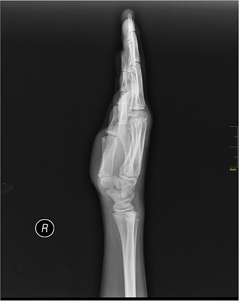 File:Medical X-Ray imaging WFQ07 nevit.jpg