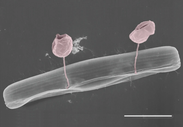 Pennate diatom from an Arctic meltpond, infected with two chytrid-like [zoo-]sporangium fungal pathogens (in false-colour red). Scale bar = 10 μm.[39]
