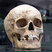 Skull found in the archaeological site of Herxheim, exhibited in the museum of Heidelberg University Schaedel Herxheim 01.jpg