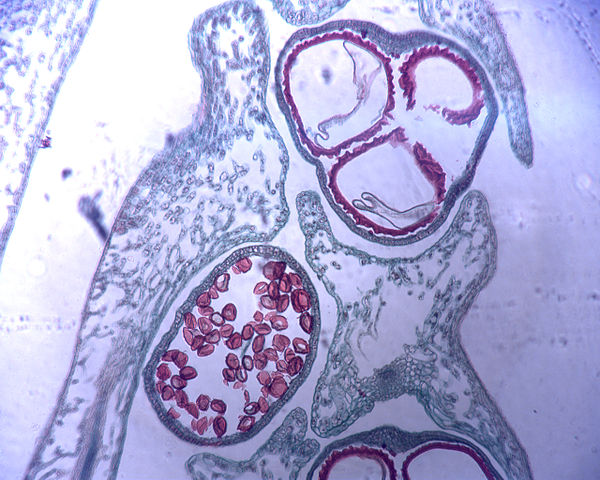 Microscopic photo of spores (in red) of Selaginella. The large three spores at the top are megaspores whereas the numerous smaller red spores at the b