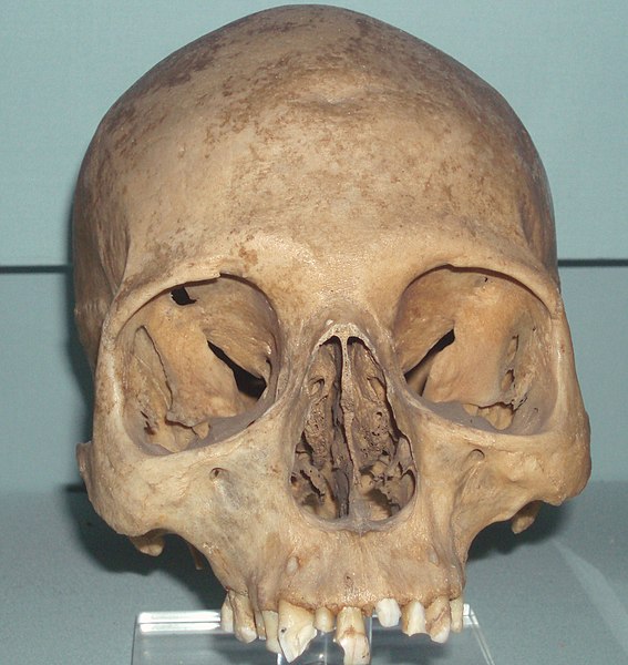File:Skull of Khety.jpg