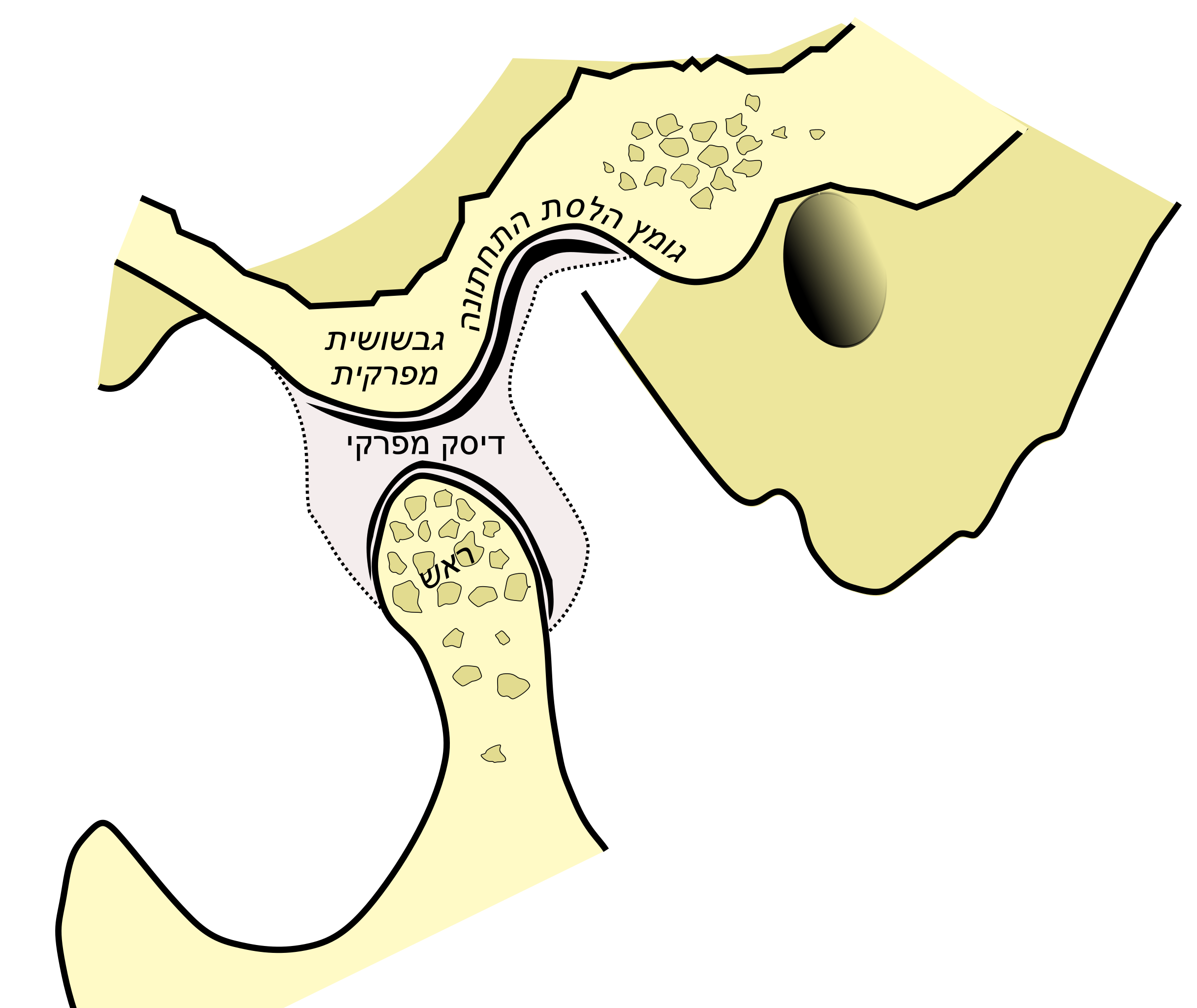 File:Dispositivo de avance mandibular Orthoapnea.jpg - Wikimedia Commons