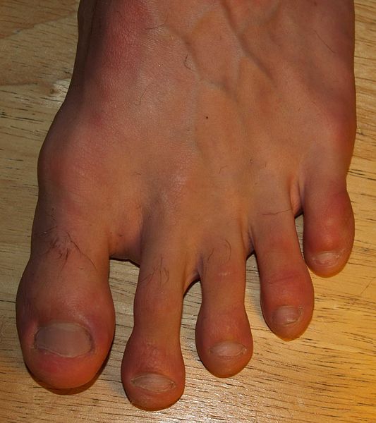 File:Toes by David Shankbone.jpg