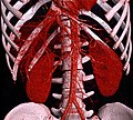 Volume rendering of hepatic veins