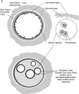 Metacestode Larval tapeworm