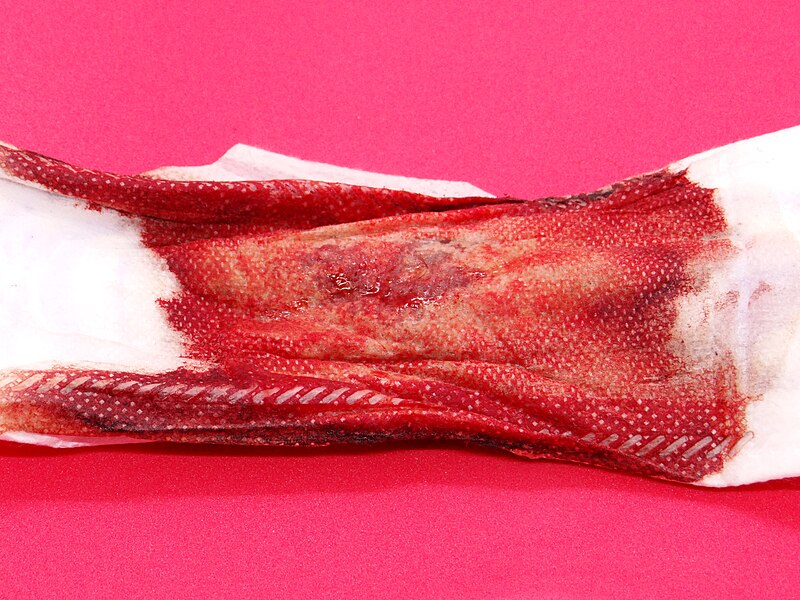 File:Withdrawal bleeding on sanitary napkin 03.jpg